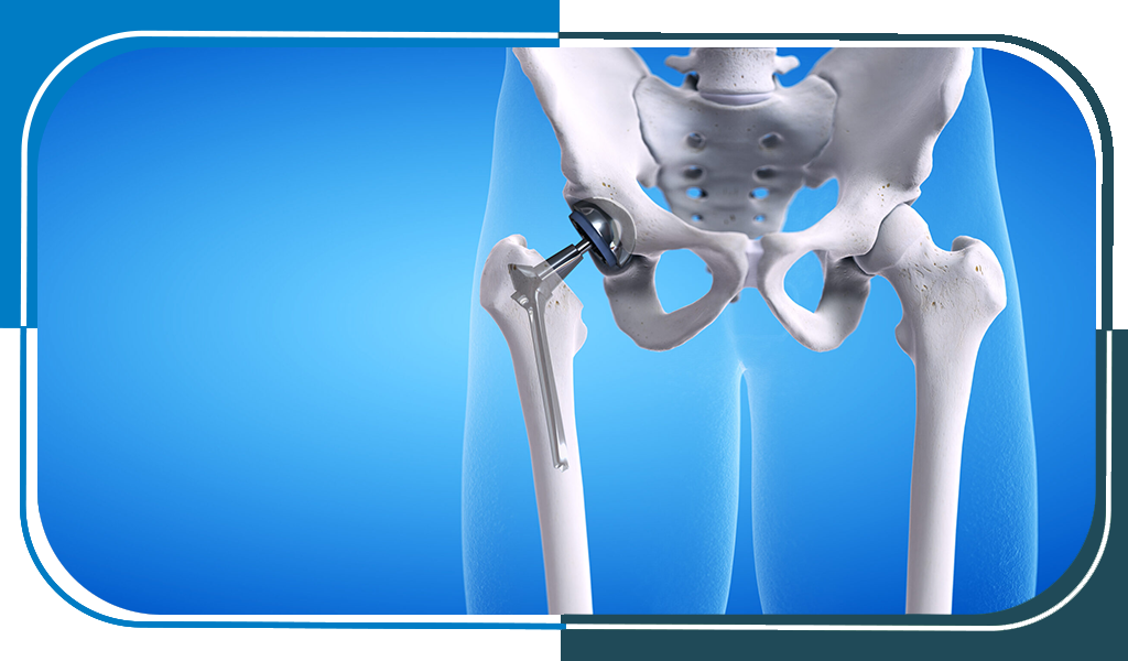 Orthopedics Department